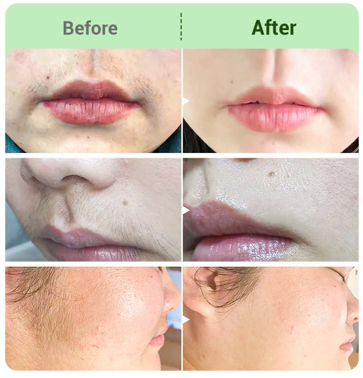 🎉Hot Sale🎉Hair Removal Cream Kit for Women